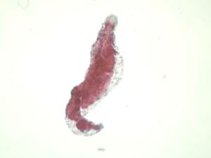<i>Fasciola hepatica</i>, Redia Slide