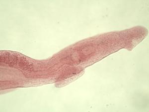 Schistosoma mansoni Slide