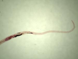 Schistosoma manson, Female Slide
