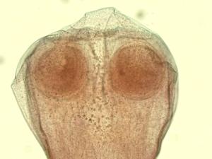 Tapeworm, Comparative Scolices Slide