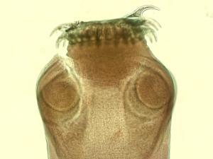 Tapeworm, Comparative Scolices Slide