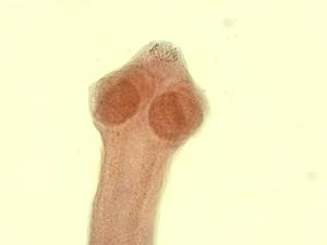 Tapeworm, Comparative Scolices Slide