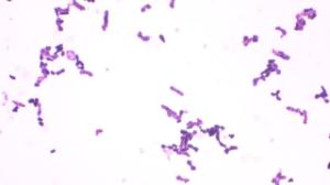 Saccharomyces, sporulation slide