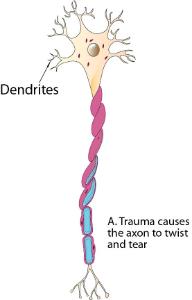 Science Take-Out® A Bang To The Head