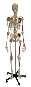 Rudiger® Super-Skeleton