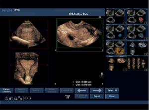 General pathology transvaginal µltrasound training model