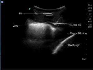 Midscapular thoracentesis µltrasound training model