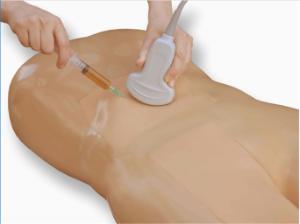 Paracentesis µltrasound training module for µltrasound guided paracentesis