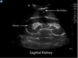 Renal biopsy µltrasound training model