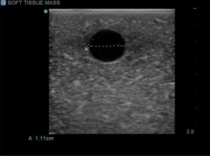 Soft tissue biopsy ultrasound training block model
