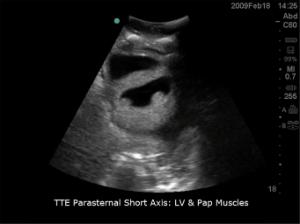 Transthoracic echocardiography and pericardiocentesis µltrasound training model