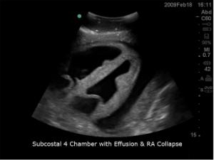 Transthoracic echocardiography and pericardiocentesis µltrasound training model