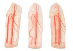 True anatomy series sclerotherapy vascular leg model