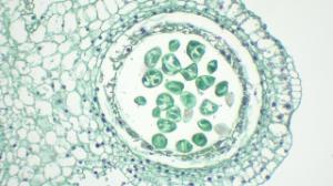 Lilium Anther-Pollen tetrads (CS) QS