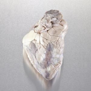 Ward's® Pure Preserved™ Hearts without Pericardium