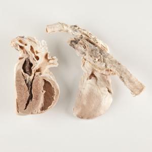 Plastinated Biological Specimens - Bisected Pig Heart