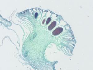 <i>Marchantia</i> Life History, Composite Slide