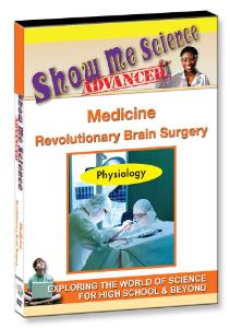 Show Me Science: Medicine–Revolutionary Brain Surgery Video