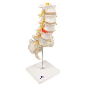 Lumbar Spinal Column