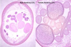 Composite male and female <i>Ascaris</i>