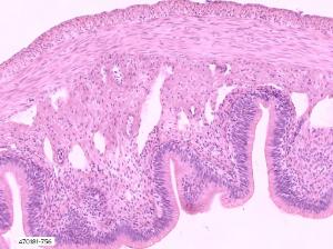 Frog large intestine