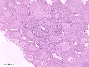 Frog ovary showing oogenesis