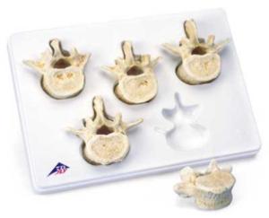 3B Scientific® BONElike™ Vertebrae Sets