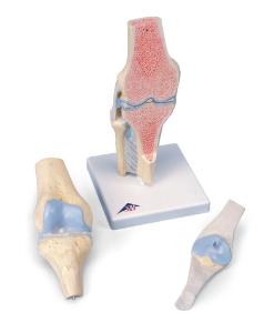 3B Scientific® Sectional Knee Joint, 3 Part