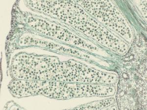 Pine, Staminate Cone Combination Slide