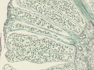 Pine, Staminate Cone Combination Slide