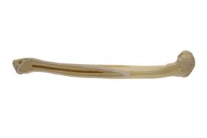 Standard Humerus