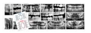 Roylco Dental X-Rays
