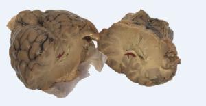 Sheep Brain with Tumors and Strokes