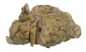 Sheep Brain with Tumors and Strokes