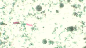<i>Entamoeba coli</i>, Trophozoites slide