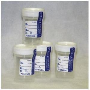 Urinalysis specimen container