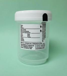 Urinalysis specimen container