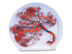 Placenta