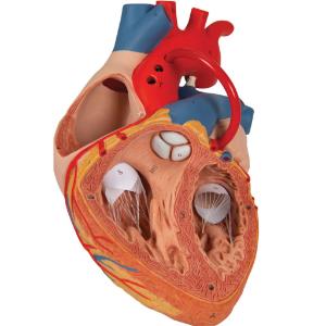 Heart with Bypass