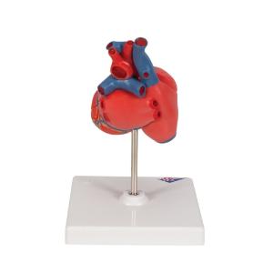 Heart with Bypass