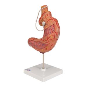 Gastric Band Model