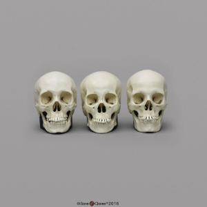BoneClones® 1:2 Scale Regional Human Skull Sets