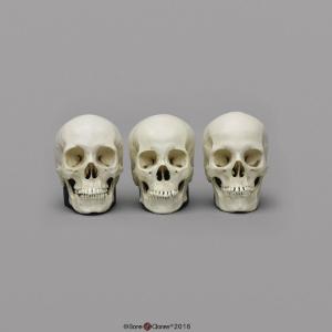 BoneClones® 1:2 Scale Regional Human Skull Sets