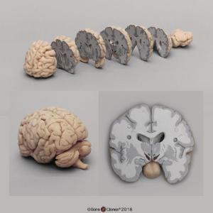 BoneClones® Sectioned Brain Model