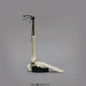 BoneClones® Ankle Sprain Model