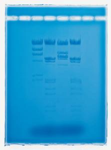 Ward's® AP Biology Investigation 9: Genetics and Information Transfer: Restriction Enzymes