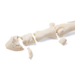 Mammal Metatarsal Bones Disarticulated