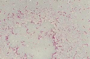 Bacterial Capsule