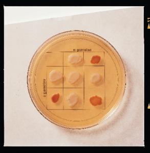 Ward's® Introduction to Genetics: A Monohybrid Cross in Yeast Lab Activity