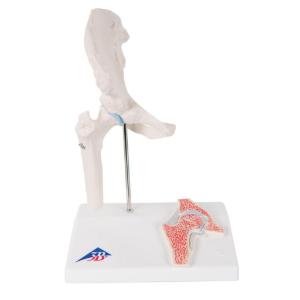 3B Scientific® Mini Joint With Cross Section Models